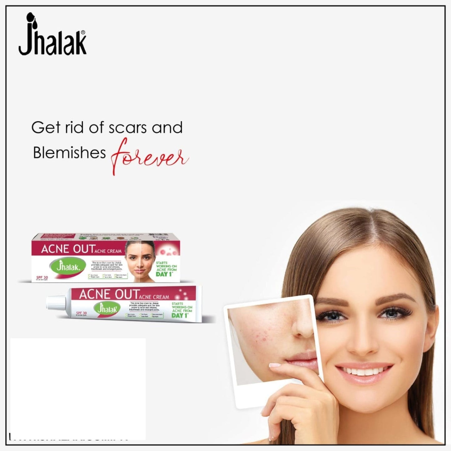 Jhalak Acni Out Cream